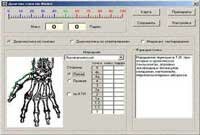 Пример рабочего окна программного обеспечения, для работы по методу Р. Фолля и Х. Шиммеля